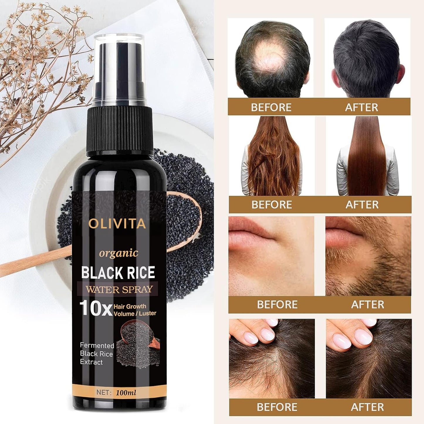 Vegan Hair Growth Serum for Women and Men, Rice Water Spray for Hair Growth